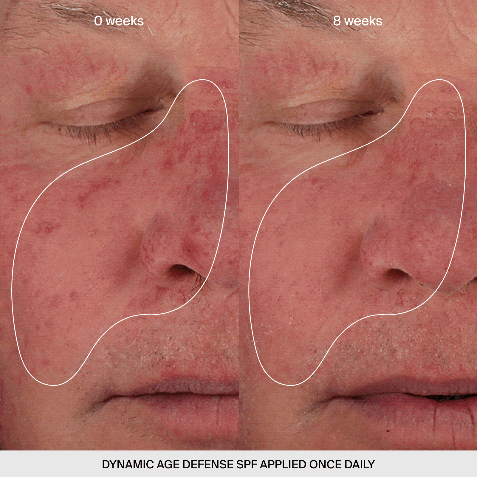 Dynamic Age Defense SPF - aqueous.