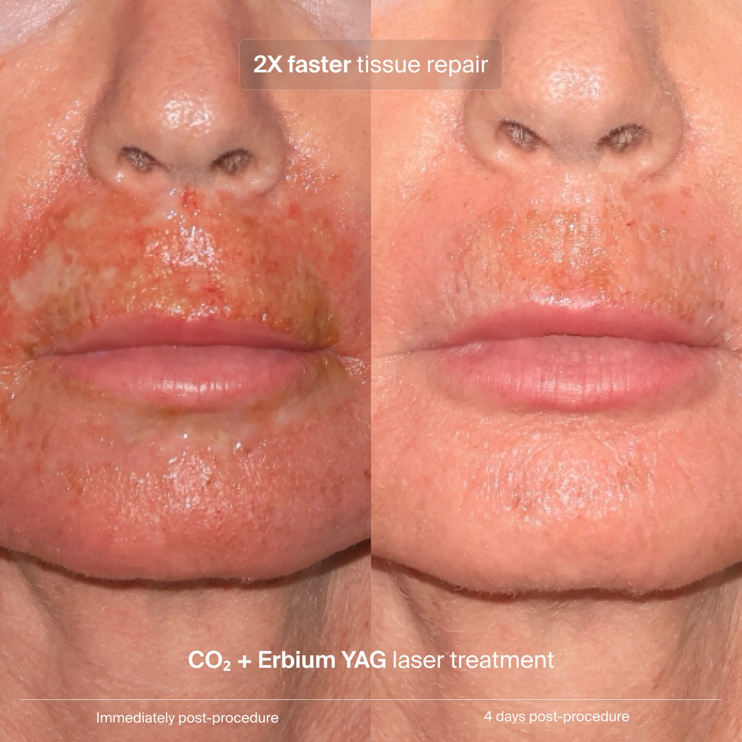 Extracellular Matrix Restore - aqueous.