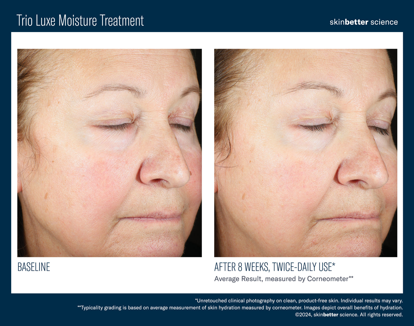 Trio Luxe Moisture Treatment - aqueous.