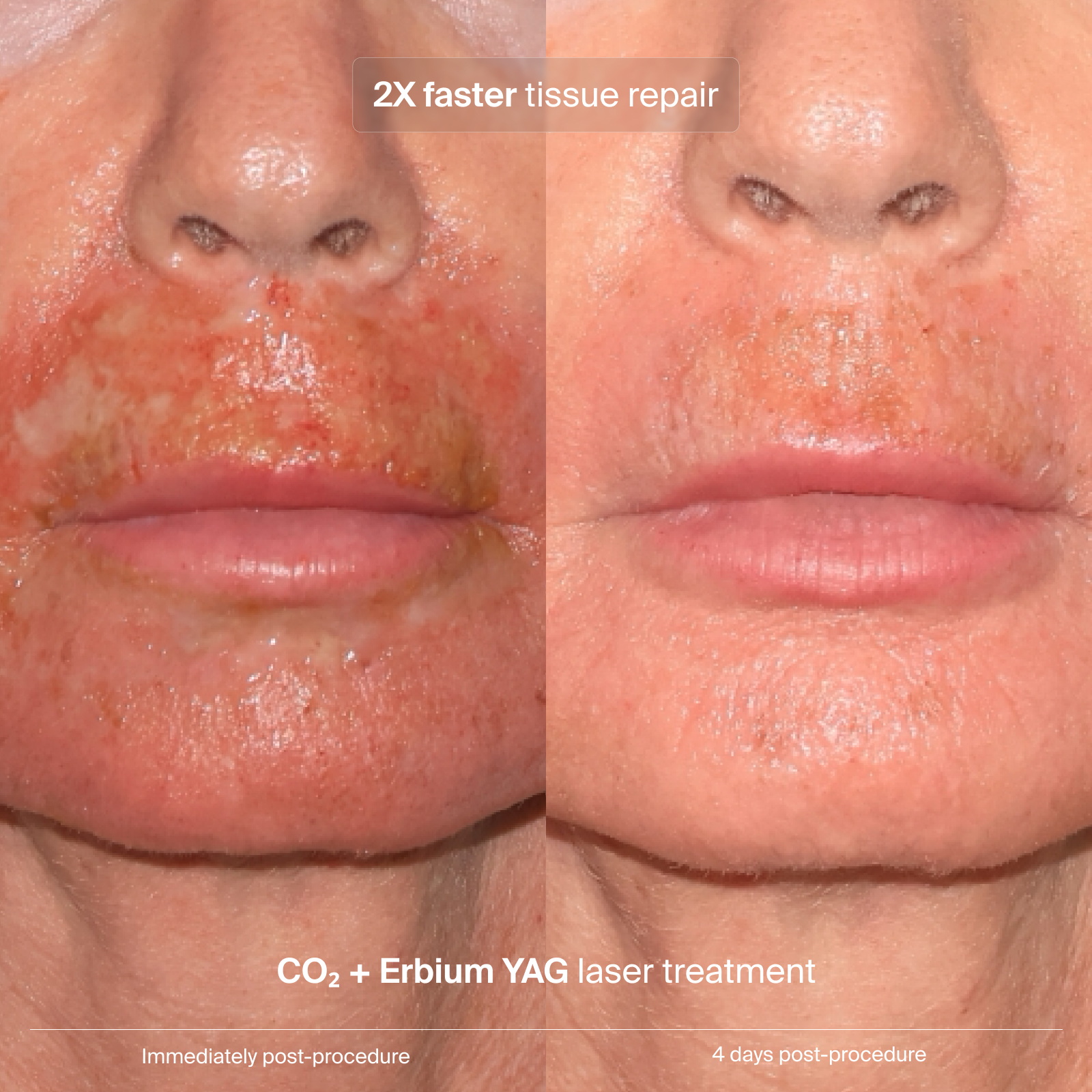 Extracellular Matrix Restore - aqueous.